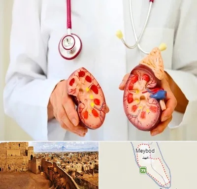 دکتر سنگ کلیه در میبد