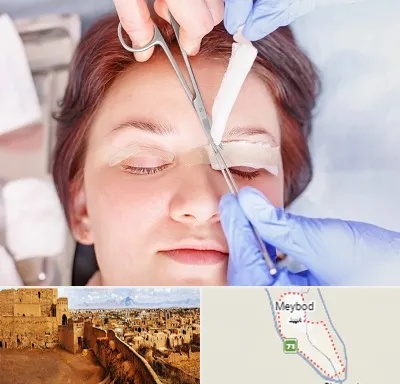 جراحی پلک افتاده در میبد