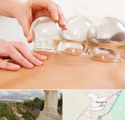 بادکش درمانی در کنگاور