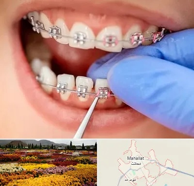 مرکز ارتودنسی دندان در محلات
