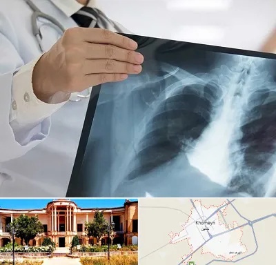 فوق تخصص ریه در خمین