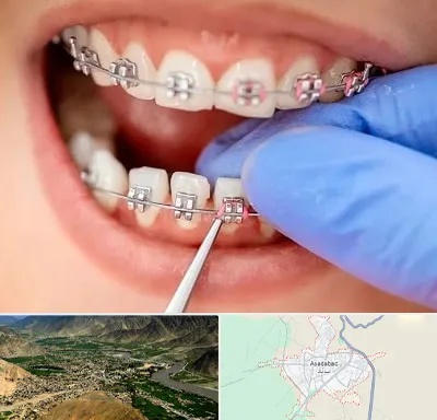 مرکز ارتودنسی دندان در اسدآباد