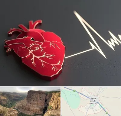 متخصص الکتروفیزیولوژی در سرپل ذهاب
