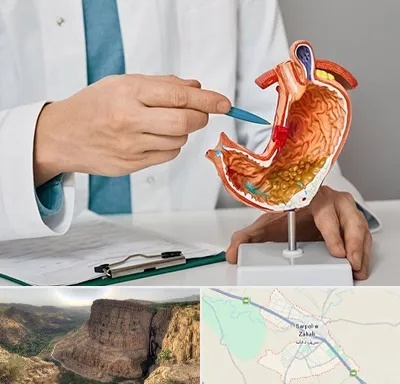 دکتر سرطان معده در سرپل ذهاب