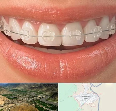 ارتودنسی اقساطی در اسدآباد