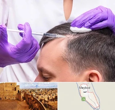 دکتر فوق تخصص پوست و مو در میبد