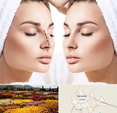 عمل بینی در محلات