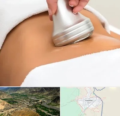 دستگاه لاغری در اسدآباد