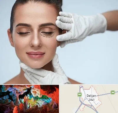 عمل پف چشم در دلیجان