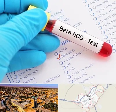 آزمایشگاه بارداری در بافق