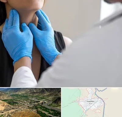 دکتر سرطان گلو در اسدآباد