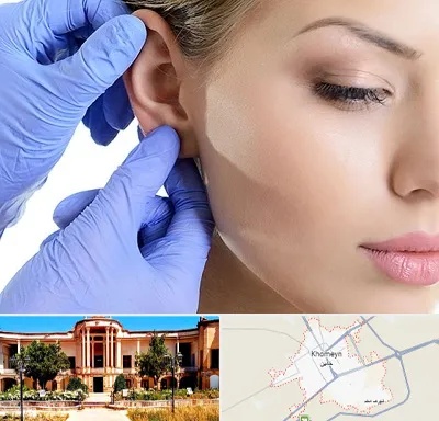 اتوپلاستی در خمین