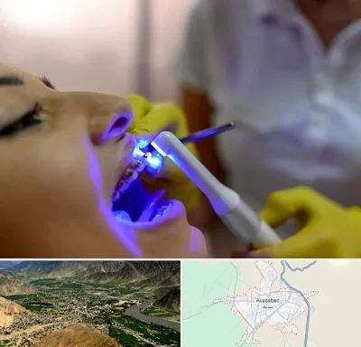 دندانپزشکی با لیزر در اسدآباد