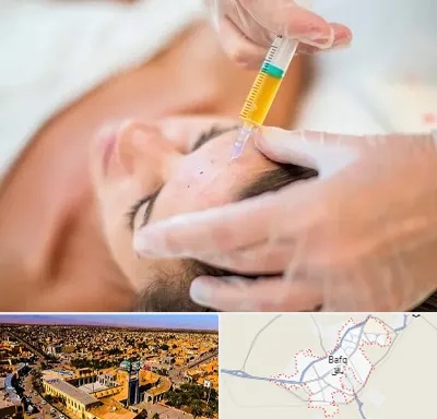 پی آر پی در بافق