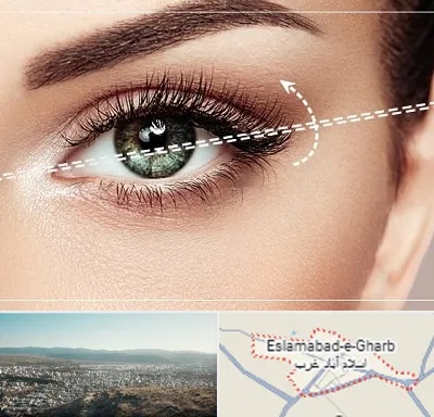 جراحی چشم گربه ای در اسلام آباد غرب
