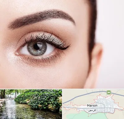 فوق تخصص عنبیه در هرسین