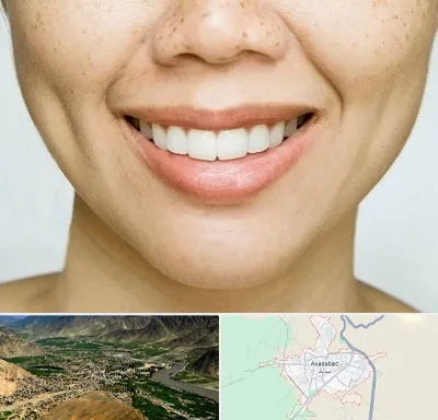 عمل چال گونه در اسدآباد