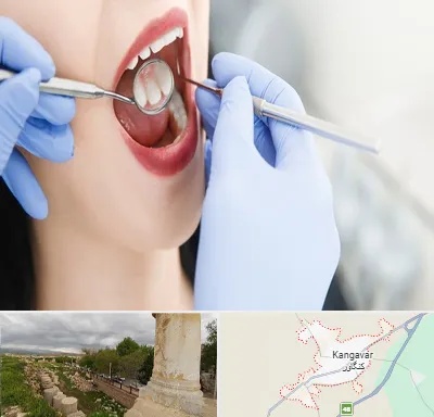 جراح دندان عقل در کنگاور