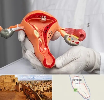 دکتر سرطان رحم در میبد