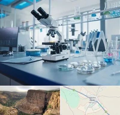 آزمایشگاه زگیل تناسلی در سرپل ذهاب