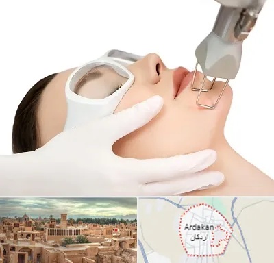 لیزر فرکشنال در اردکان
