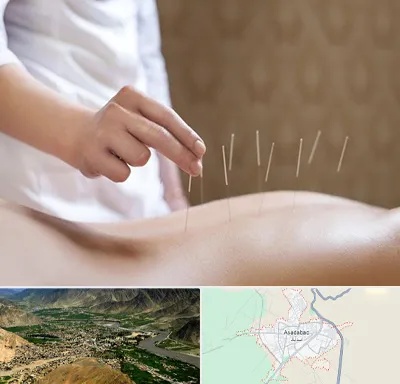 درای نیدلینگ در اسدآباد