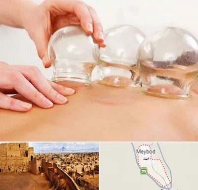 بادکش درمانی در میبد