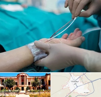 آنژیوگرافی در خمین