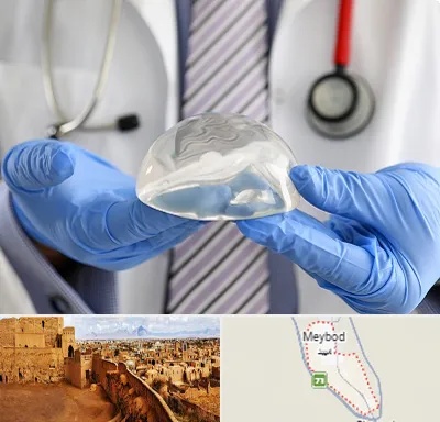 ماموپلاستی در میبد