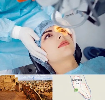 دکتر عمل لیزیک چشم در میبد