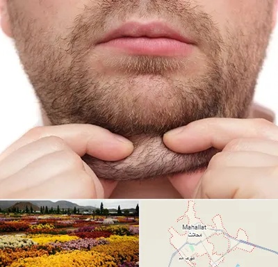 ساکشن غبغب در محلات