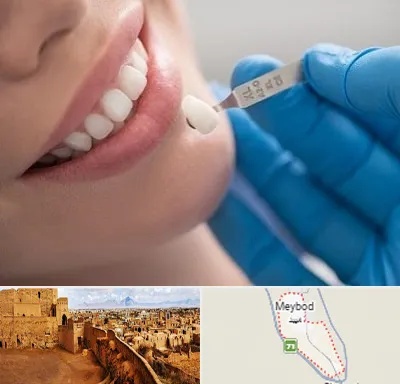 مرکز لمینت دندان در میبد