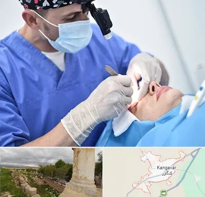جراح سرطان چشم در کنگاور