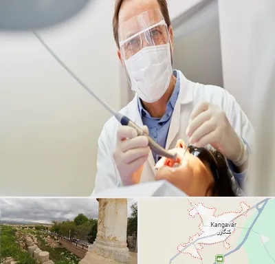 جراح لثه در کنگاور