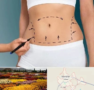 دکتر طب سنتی برای لاغری در محلات