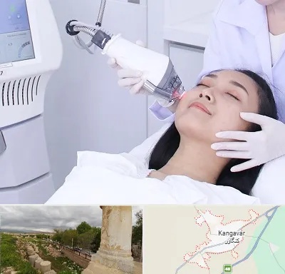وایتنینگ در کنگاور