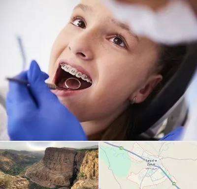 دکتر ارتودنسی کودکان در سرپل ذهاب