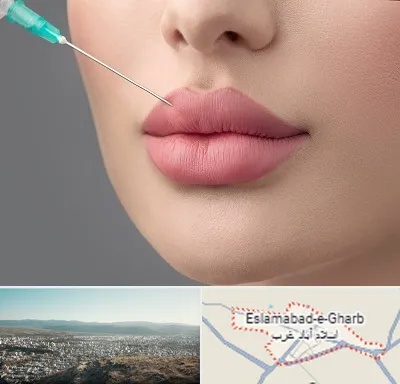 کلینیک ژل لب روسی در اسلام آباد غرب