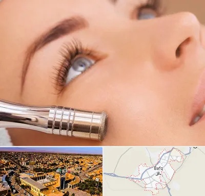میکرودرم در بافق