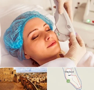 اکسنت در میبد