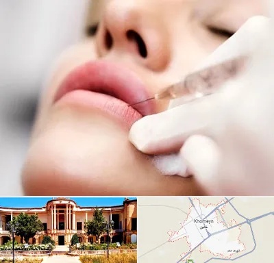کلینیک تزریق ژل لب در خمین