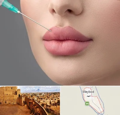 کلینیک ژل لب روسی در میبد
