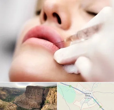 کلینیک تزریق ژل لب در سرپل ذهاب