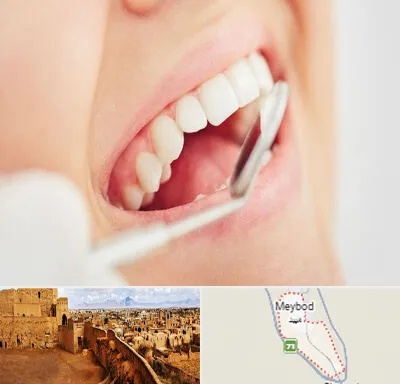 اصلاح طرح لبخند در میبد