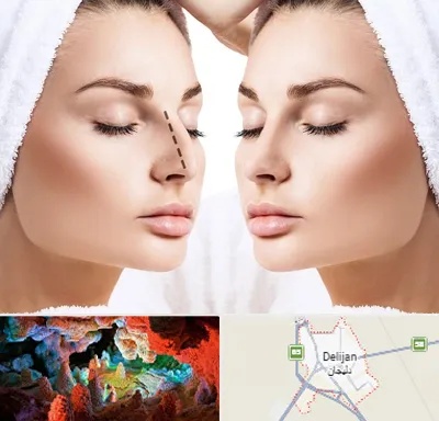 عمل بینی در دلیجان