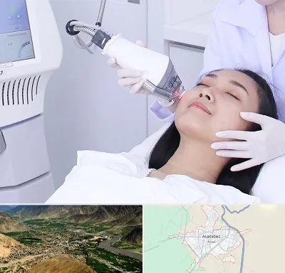 وایتنینگ در اسدآباد