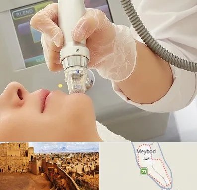 آر اف فرکشنال در میبد