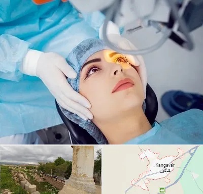 دکتر عمل لیزیک چشم در کنگاور