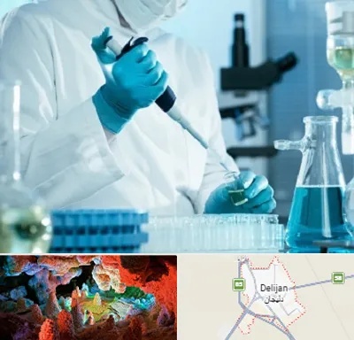 آزمایشگاه HIV در دلیجان