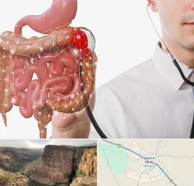 دکتر سرطان روده بزرگ در سرپل ذهاب